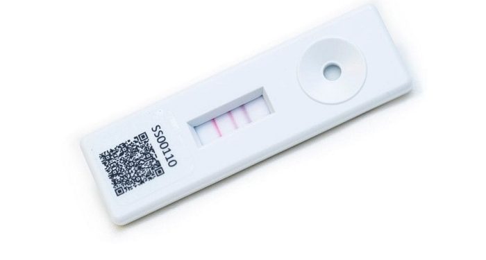 El importante papel del oro en los dispositivos para diagnosticar el coronavirus